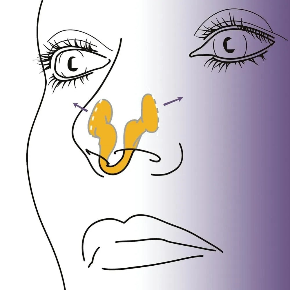Silicone Nasal Dilator – Sinus Relief & Snoring